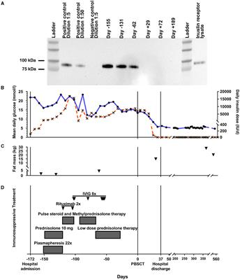 Case report: Allogeneic stem cell transplantation for type B insulin resistance